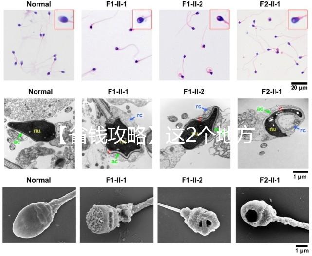 【省錢(qián)攻略】這2個(gè)地方購(gòu)買(mǎi)黃體酮膠囊可用醫(yī)保報(bào)銷(xiāo)