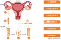 玉溪到昆華醫(yī)院做試管嬰兒怎么樣？詳細費用明細如下