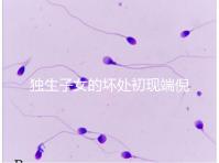 獨生子女的壞處初現端倪，贍養父母已成難題