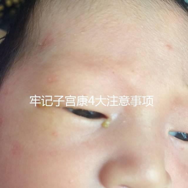 牢記子宮康4大注意事項(xiàng)，輕松避免胃脹、腹瀉等副作用