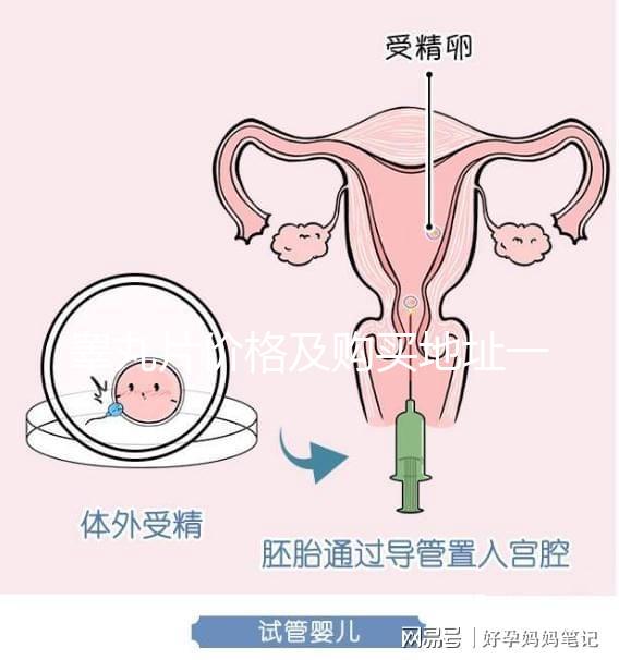 睪丸片價(jià)格及購買地址一覽 只需198元
