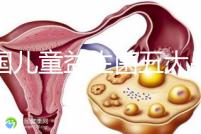 美國(guó)兒童益生菌五大品牌排行榜，康萃樂(lè)、家得路榜上有名