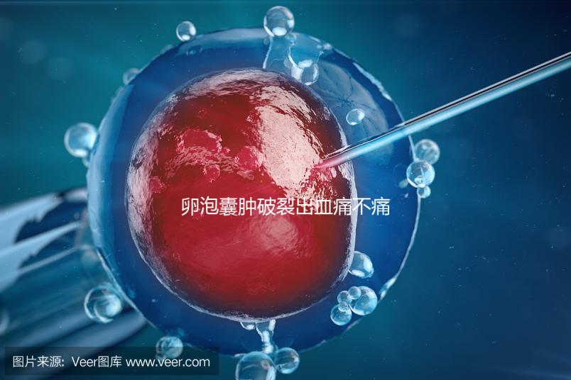 卵泡囊腫破裂出血痛不痛？經歷過的姐妹們給出回應