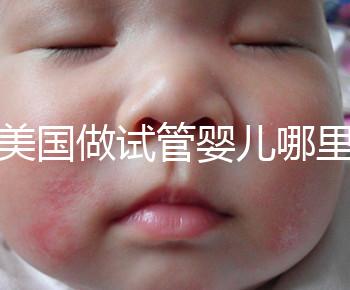 去美國做試管嬰兒哪里最好，4家好評輔助生殖機(jī)構(gòu)推薦