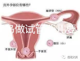 去青島做試管嬰兒要多少錢？