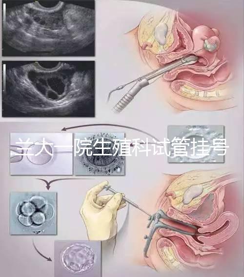 蘭大一院生殖科試管掛號多少錢別還不造，預(yù)約攻略來了