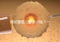 做試管嬰兒要多少錢?一起算筆經(jīng)濟(jì)賬