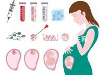 辦準生證沒必要隱瞞生育史，女方再婚需帶離婚證