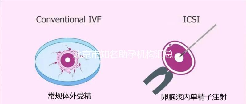 北京市知名助孕機構(gòu)匯總，成功率多少一看便知！