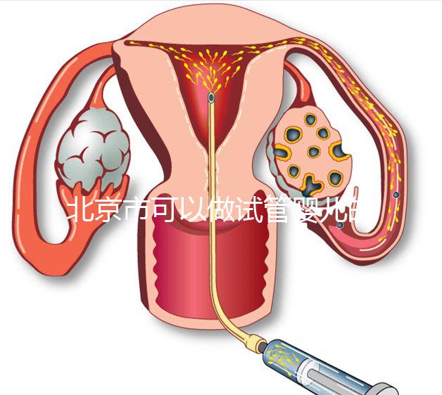 北京市可以做試管嬰兒的公立醫院有哪些