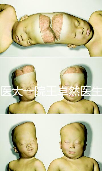 哈醫大一院王卓然醫生試管攻略,坐診時間、成功率早知道