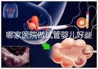 哪家醫(yī)院做試管嬰兒好些?