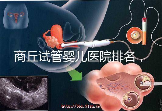商丘試管嬰兒醫(yī)院排名，附3家公立機(jī)構(gòu)助孕成功率和費(fèi)用