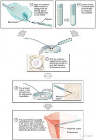 國內首起試管嬰兒案例,法律竟難以給患者維權