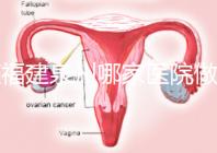 在福建泉州哪家醫(yī)院做試管嬰兒好