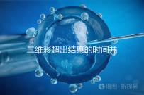 二維彩超出結(jié)果的時(shí)間并不長，從檢查流程便可看出