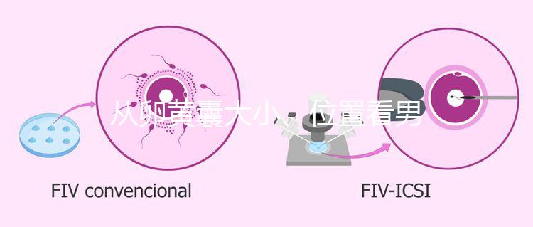 從卵黃囊大小、位置看男女，寶寶性別分辨一眼就準