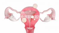上海瑞金醫(yī)院宮腔鏡檢查多少錢？專家：流程簡單性價比高
