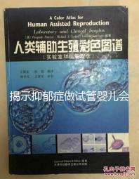 揭示抑郁癥做試管嬰兒會(huì)遺傳給女兒，想避免看這個(gè)
