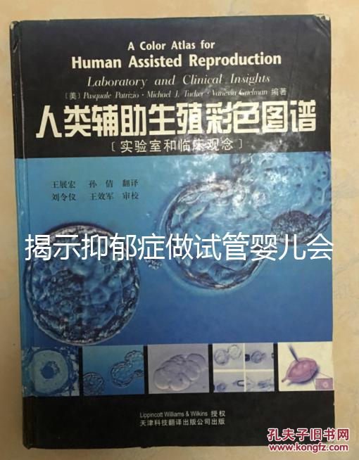 揭示抑郁癥做試管嬰兒會遺傳給女兒，想避免看這個