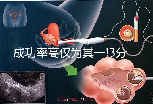 成功率高僅為其一!3分鐘看懂俄羅斯試管嬰兒的4大優(yōu)勢