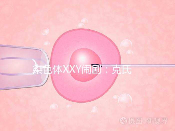 染色體XXY鬧?。嚎耸暇C合征，帶你走進“第三性別”群體