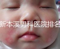 更新本溪男科醫(yī)院排名，不要錯(cuò)過(guò)本溪湖區(qū)top3醫(yī)生的專業(yè)