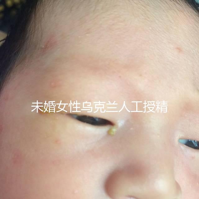 未婚女性烏克蘭人工授精必看！醫療及生活費用明細預覽