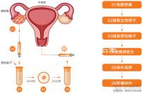 無性婚姻做試管嬰兒后來怎么樣？三個大案例揭開了內幕