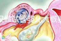 武漢做試管嬰兒大概要多少錢？