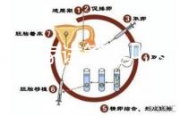 浙江27家試管嬰兒醫院成功率排名公開，邵逸夫醫院位居前十
