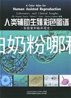 水解蛋白奶粉哪種好？口感和消化分析這個品牌出彩