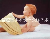 宮腔鏡手術(shù)長(zhǎng)什么樣？術(shù)后要注意什么？ ?