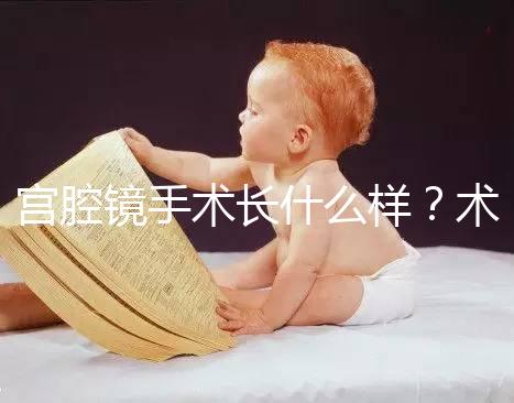 宮腔鏡手術(shù)長(zhǎng)什么樣？術(shù)后要注意什么？ ?