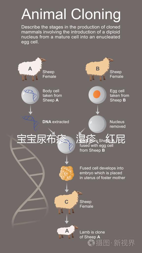 寶寶尿布疹、濕疹、紅屁股傻傻分不清？4點區(qū)別輕松診斷