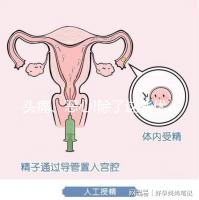 頭痛、惡心!除了這些優思明副作用還有哪些