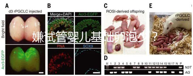 嫌試管嬰兒基礎卵泡少？并非只能食療，這份增多錦囊請收下