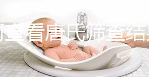 如何查看唐氏篩查結果，珠海醫院價格二百四起