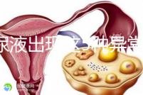 當尿液出現這5種異常情況，那么腎功能檢查刻不容緩