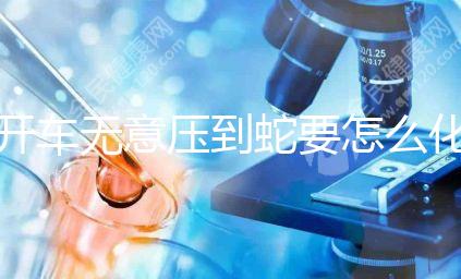 開車無意壓到蛇要怎么化解進(jìn)來瞧，要不要報警一目了然