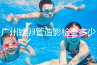 廣州輸卵管造影檢查多少錢，預約時間一次說清楚，想去看