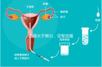選擇大于努力，空軍總醫(yī)院做試管嬰兒必讀攻略