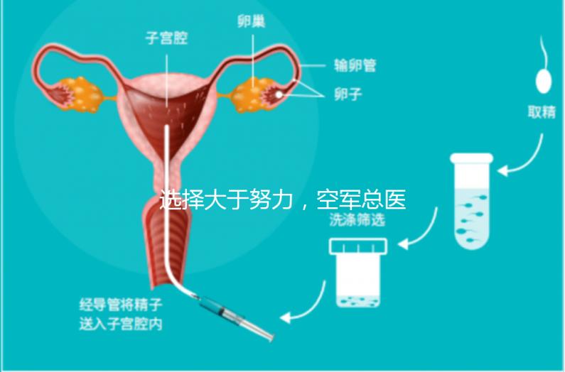 選擇大于努力，空軍總醫院做試管嬰兒必讀攻略
