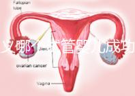 遵義哪個試管嬰兒成功率高？貴州生殖中心醫院2024年排名參考