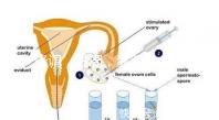 降調(diào)，進周，囊胚……這些試管嬰兒助孕術(shù)語你都懂嗎？