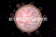 胎兒留級(jí)的四大原因找到了！多半和媽媽太懶不運(yùn)動(dòng)有關(guān)系