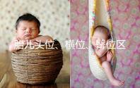 胎兒頭位、橫位、臀位區別大，5個方面教你分辨