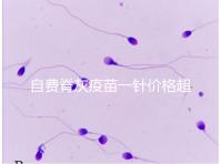 自費(fèi)脊灰疫苗一針價(jià)格超200！與免費(fèi)糖丸相比各有優(yōu)缺點(diǎn)