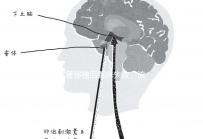 試管移植后著床失敗、流產？可能是“封閉抗體”出了問題