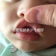 試管取卵多少個(gè)最好